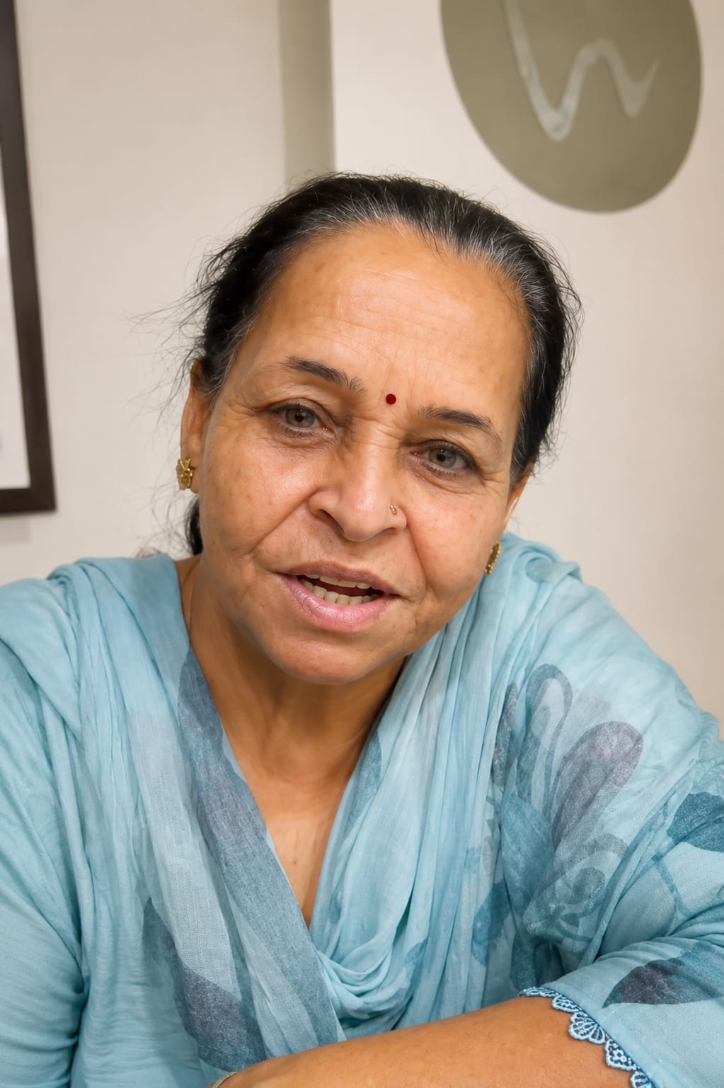 Implants & Dentures — The DentalBrace Clinic Bathinda Dental implants and complete dentures treatment result at The DentalBrace Clinic Bathinda — patient Usha Rani showing fixed dentures by Dr. Ritu Saneja Gold Medalist Prosthodontist, best dental implants clinic in Bathinda Punjab India
