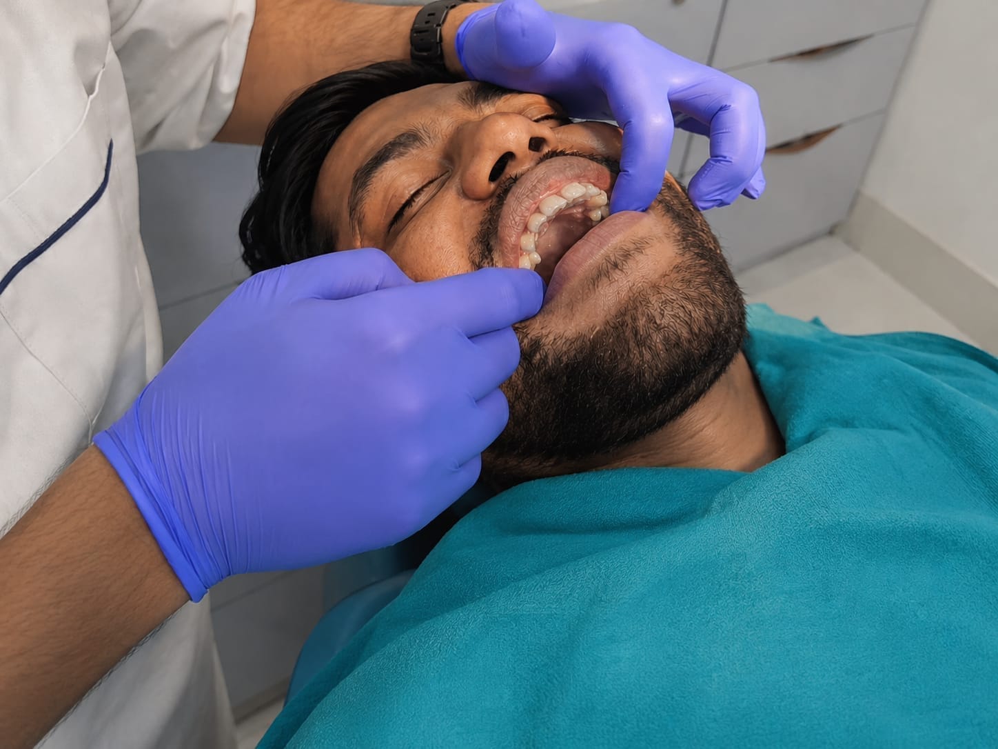 Clear Aligners — The DentalBrace Clinic Bathinda Clear aligners orthodontic treatment result at The DentalBrace Clinic Bathinda — patient Piyush showing straight teeth after clear aligner therapy by Dr. Sandeep Kumar MDS Orthodontist, best Invisalign provider in Bathinda Punjab India